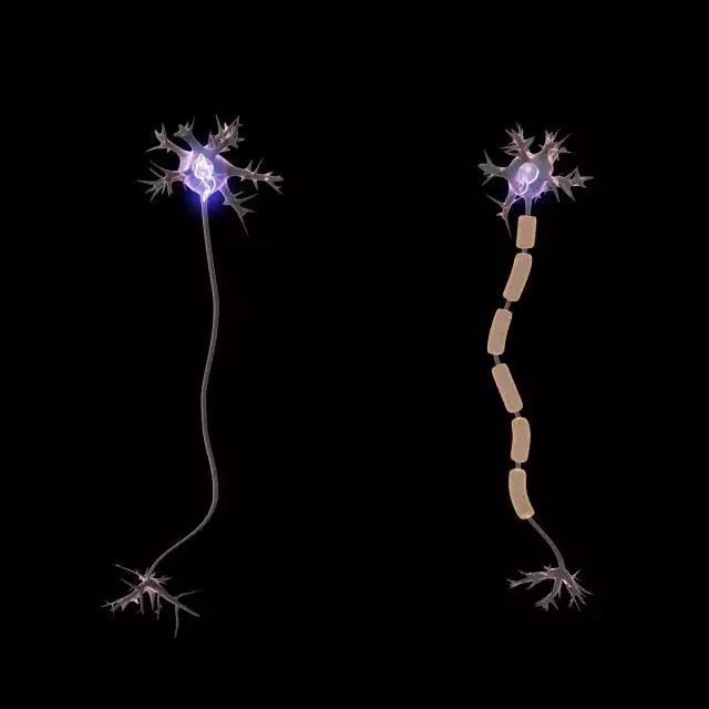 馬斯克腦機融合系統Neuralink