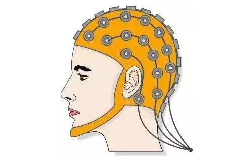 馬斯克腦機融合系統Neuralink